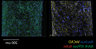 原位血管内皮细胞(左)和小管上皮细胞(右), 染色:细胞核(蓝色), VeCAD(黄色), NA/K atp酶(绿色), 肌动蛋白(红色)